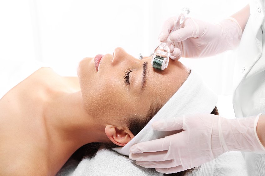 CUSTOMIZE YOUR APPOINTMENT Blondie's microneedling services