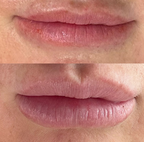 before and after 1 before and after 1