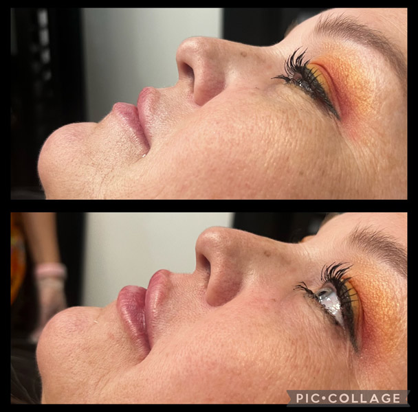 before and after 2 before and after 2