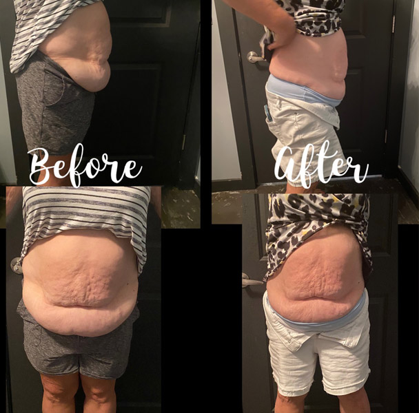 before and after before and after