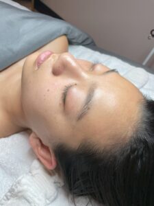 Transform Your Skin at Blondie's Chem peel after