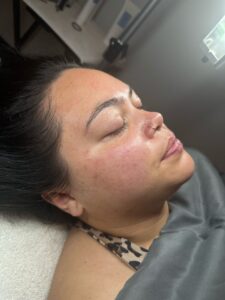 Transform Your Skin at Blondie's IMG 4685