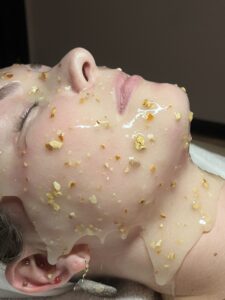 Transform Your Skin at Blondie's IMG 6594